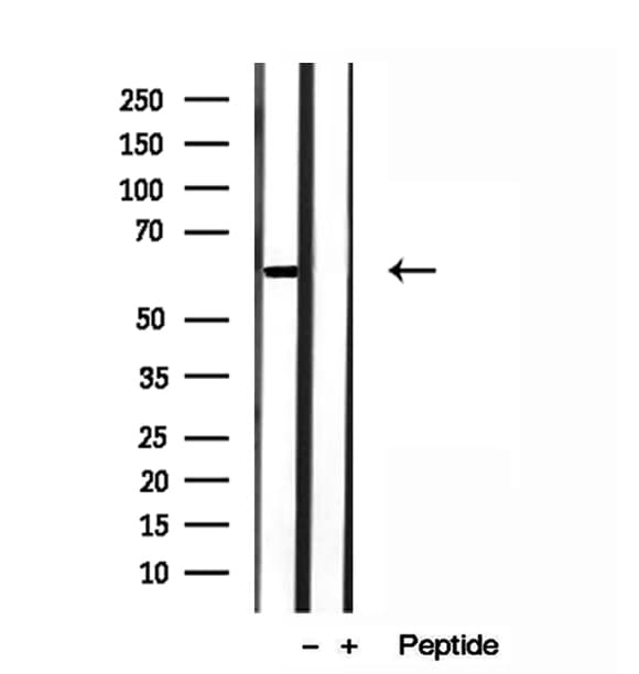 Polyclonal Rabbit anti-Human HEPACAM Antibody (IHC, WB)