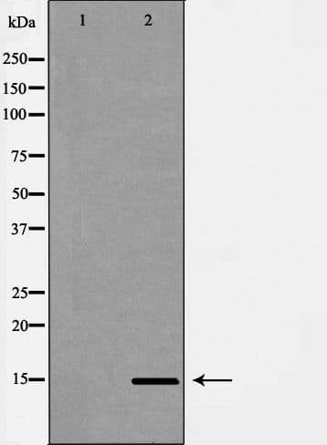 CYB5A / Cytochrome b5 Antibody