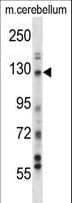 USP15 Antibody (aa254-282)