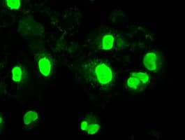 NEUROG1 / NGN1 / Neurogenin 1 Antibody (clone OTI9A8)