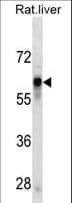 Monoclonal Mouse anti-Human Antithrombin-III Antibody (aa364-393, WB)