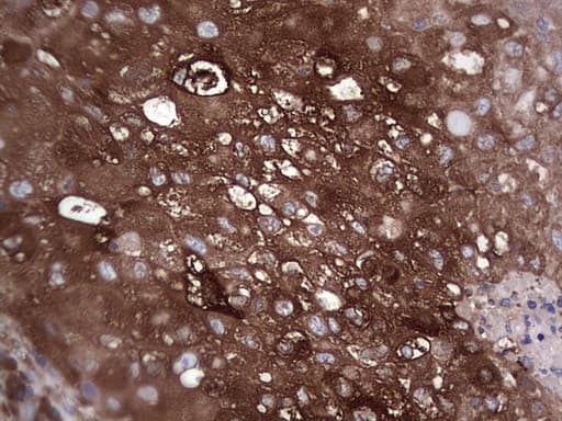 GARS / Glycyl tRNA Synthetase Antibody (clone OTI4G4)