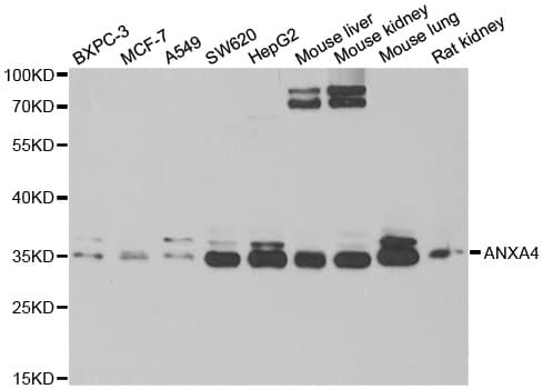 IHC-plus™ ANXA4 / Annexin IV Antibody