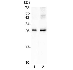 AQP5 / Aquaporin 5 Antibody