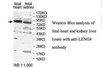 IHC-plus™ Polyclonal Rabbit anti-Human LENG8 Antibody (aa489-664, IHC, WB)