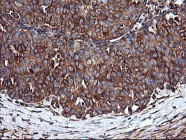 ENPEP / Aminopeptidase A Antibody (clone OTI3G1)