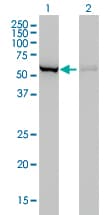 IHC-plus™ CBS Antibody (clone 3E1)