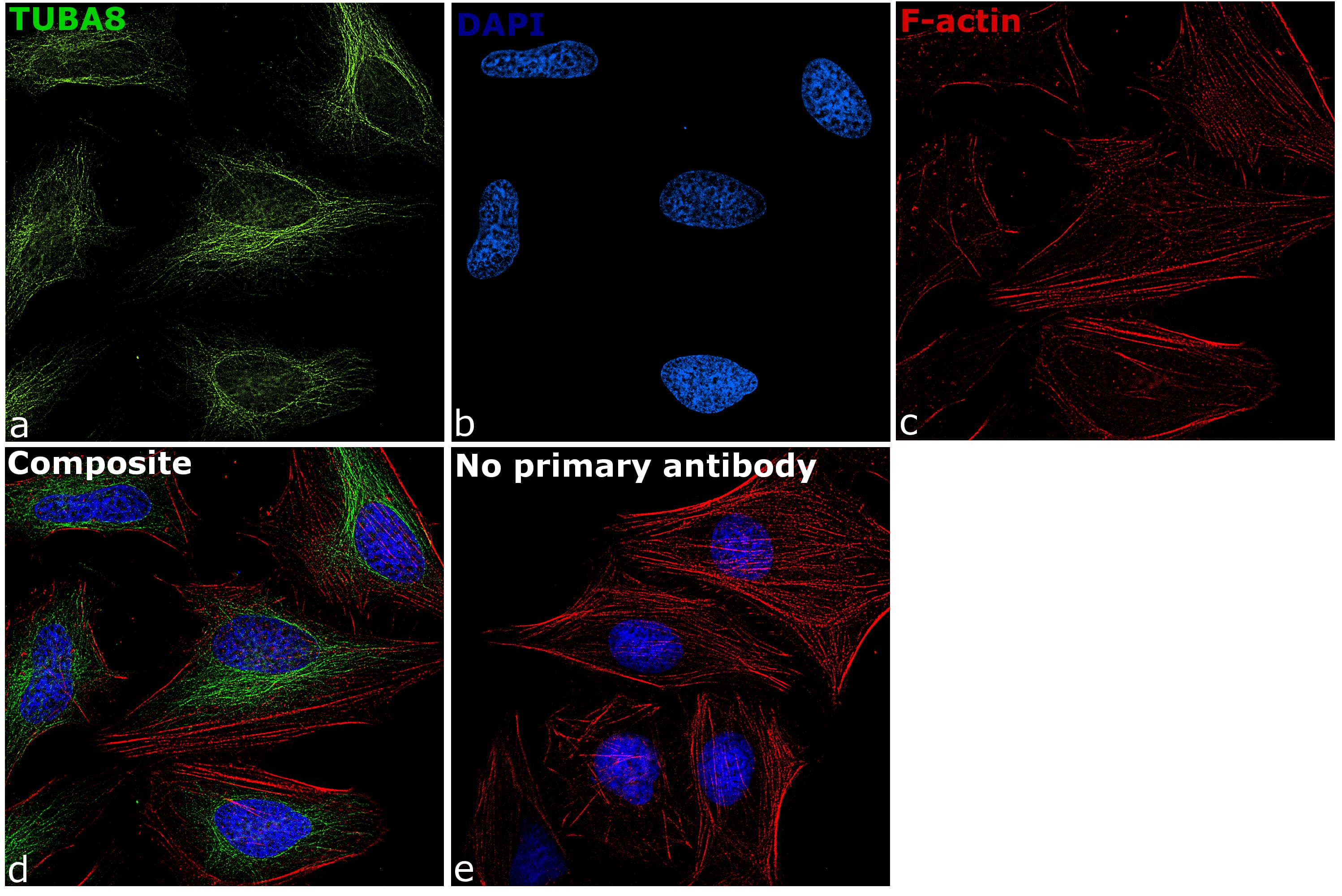 TUBA8 / Tubulin Alpha 8 Antibody (clone 2D6)