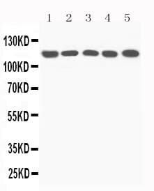 Complement C5 Antibody (aa1-18)