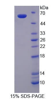 Human G6PD Protein (Recombinant His)