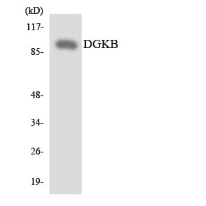 Polyclonal Rabbit anti-Human DGKB / DGK Beta Antibody (aa640-689, WB)