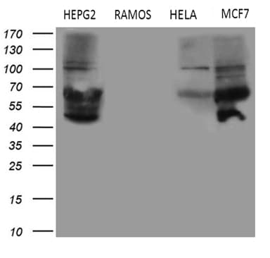 Monoclonal Mouse anti-Human MYCN / N-myc Antibody (clone OTI1D9, Carrier-free, aa229-464, WB)