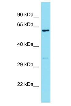 ZFX Antibody (aa519-568)