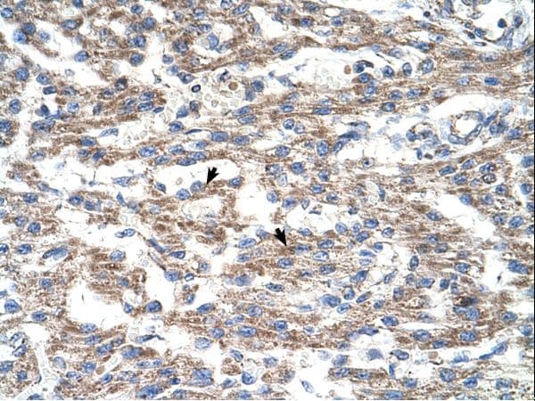 Polyclonal Rabbit anti-Human DUT / DUTPase Antibody (aa35-84, IHC, WB)