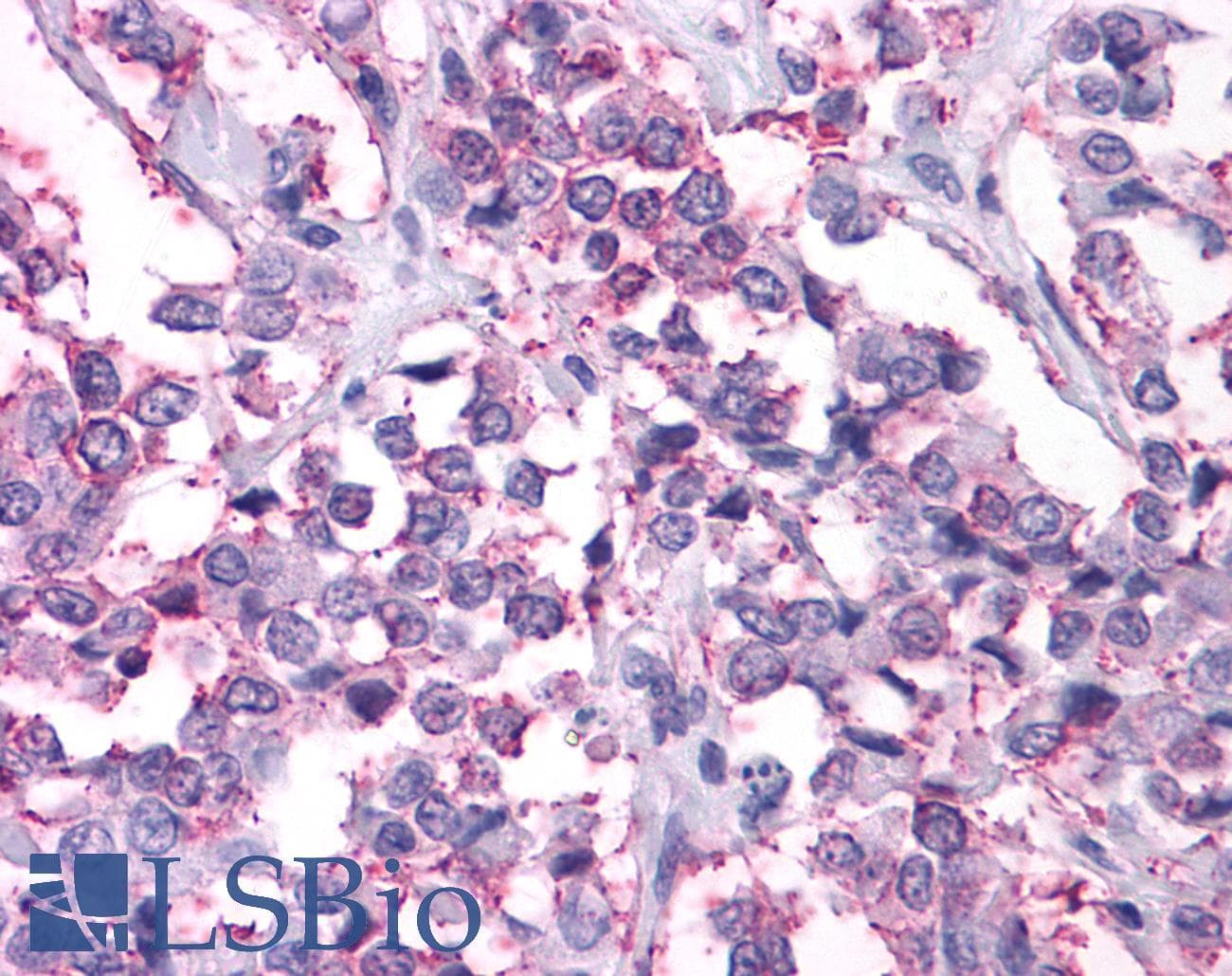 IHC-plus™ NPY2R Antibody (C-Terminus)
