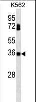 CSNK2B / Phosvitin Antibody
