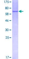 Human MTHFD2 Protein (Recombinant GST)