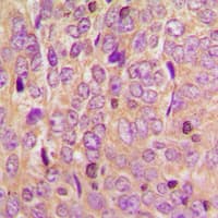 Polyclonal Rabbit anti-Human MtTFA / TFAM Antibody (Internal, IHC, IF, WB)