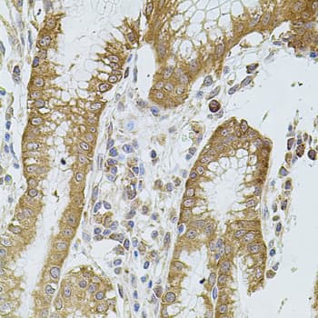 CYBB / NOX2 / gp91phox Antibody