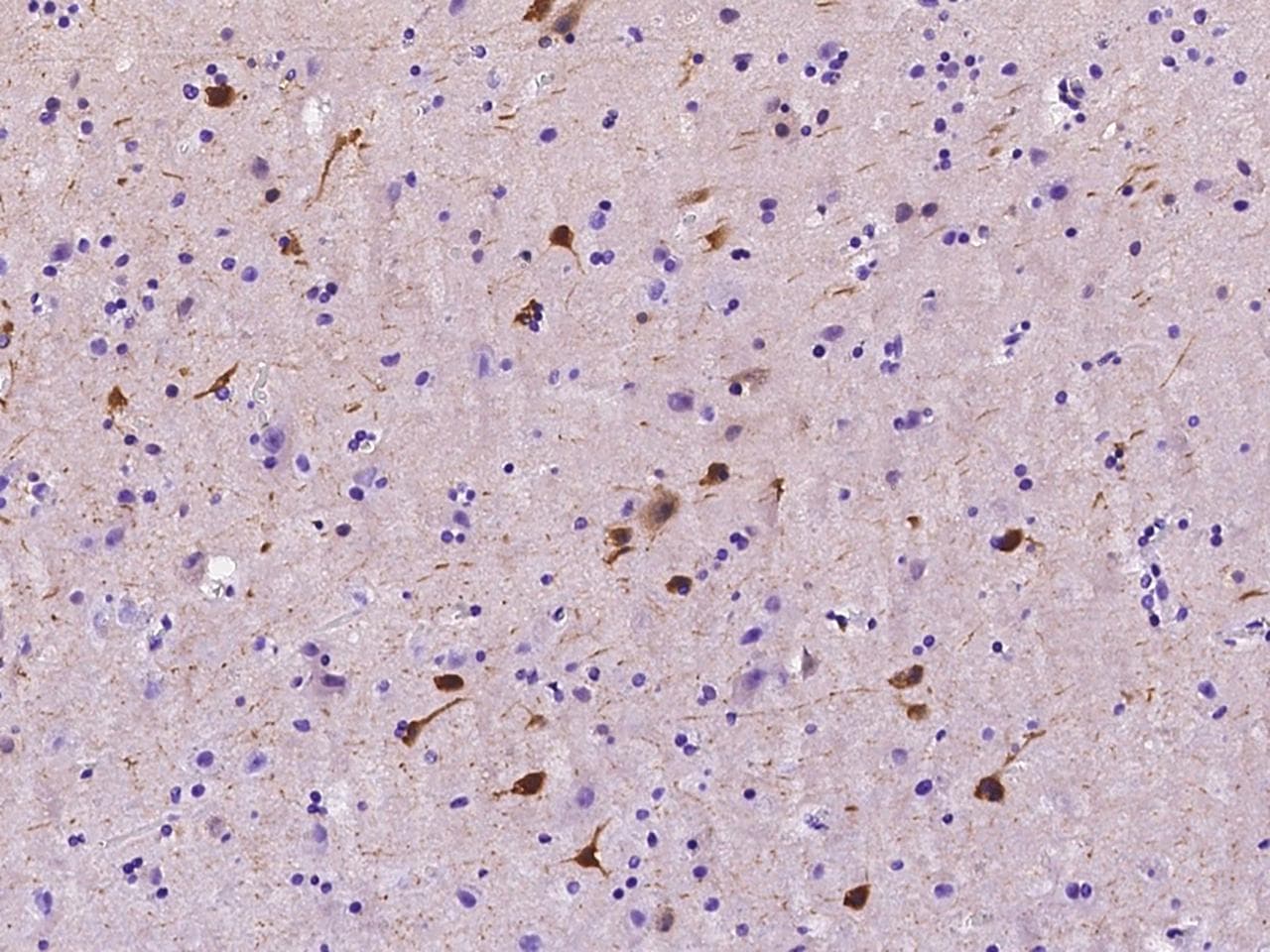 Polyclonal Rabbit anti-Human CRYM Antibody (IHC, WB)