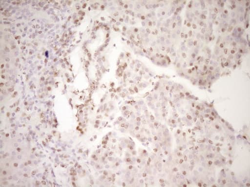 LPIN1 / Lipin 1 Antibody (clone OTI8F10)