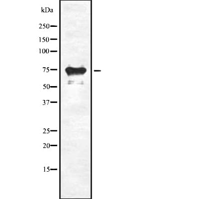 SLC34A2 / NaPi-2b Antibody (aa19-45)