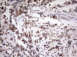 ZEB1 / AREB6 Antibody (aa1-350, clone OTI3G6)