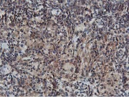 AKT1 Antibody (clone OTI4G4)
