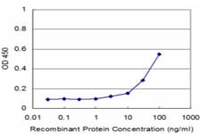 IHC-plus™ Monoclonal Mouse anti-Human PKN1 Antibody (clone 1A4, IHC, WB)
