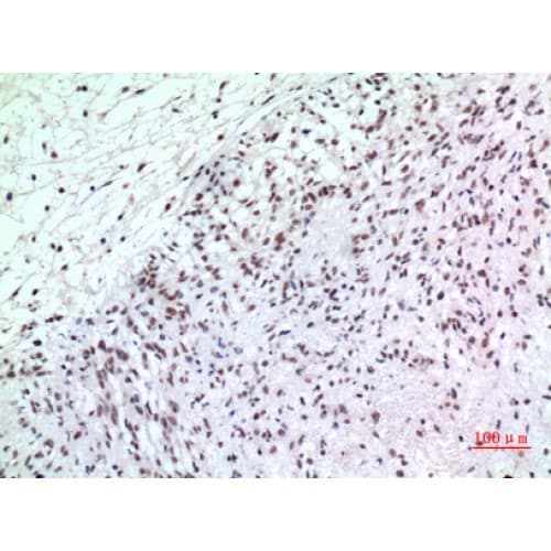 CDKN1C / p57 Kip2 Antibody
