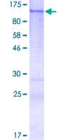 Human CCDC87 Protein (Recombinant GST)