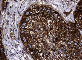 HSPD1 / HSP60 Antibody (clone OTI6F11, Carrier-free)