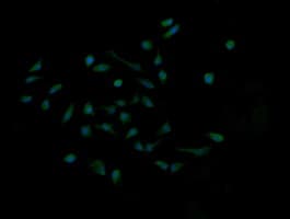 MAP2K1 / MKK1 / MEK1 Antibody (clone OTI2E8)