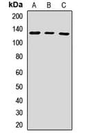 RENT1 / UPF1 Antibody