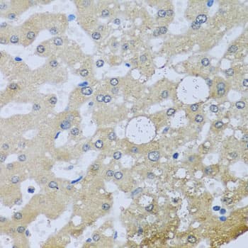 UQCR10 / UCRC Antibody