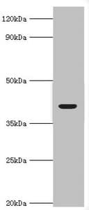 Polyclonal Rabbit anti-Human ADH4 Antibody (aa1-380, IHC, WB)