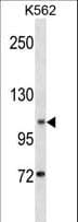 ANO1 / DOG1 / TMEM16A Antibody (aa453-482)