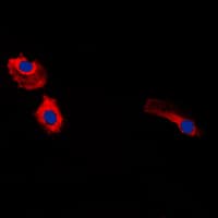 Gastrin Antibody (Internal)