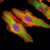 MATN1 / Matrilin 1 Antibody (clone 5A8)