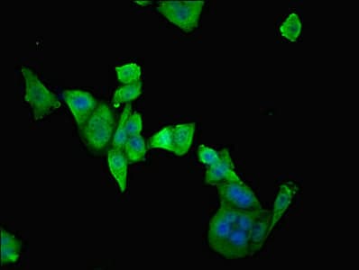 ETFDH Antibody
