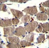 Polyclonal Rabbit anti-Human GSAP / PION Antibody (aa537-565, IHC, WB)