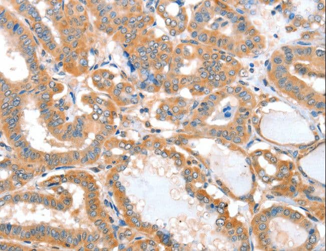 ACOT11 / THEA Antibody