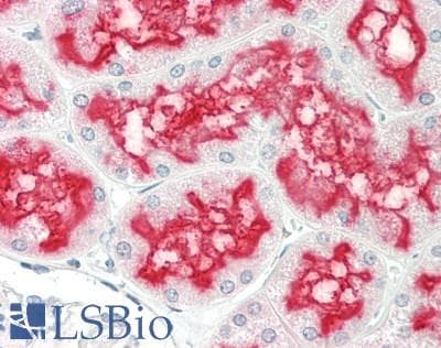 IHC-plus™ Polyclonal Rabbit anti-Human ORAOV1 Antibody (Internal, IHC, IF, WB)