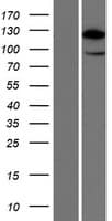HIP1R Protein (Over-Expression Lysate Myc-DDK (Flag))