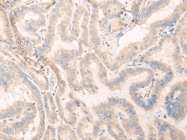 SEPT10 /Septin 10 Antibody