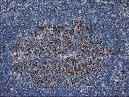DLD / Diaphorase / E3 Antibody (clone OTI4E11)