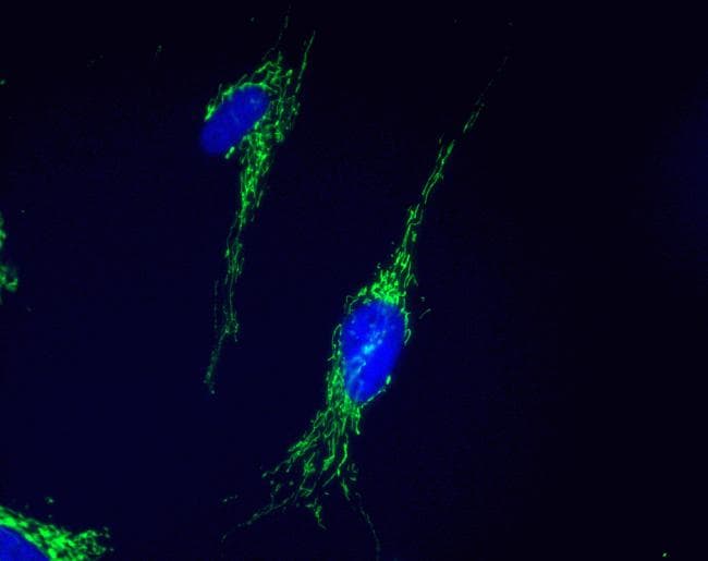 Monoclonal Mouse anti-Human DECR1 Antibody (clone 8B1AD10, IHC, IF)