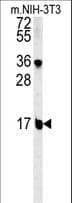 Polyclonal Rabbit anti-Human BLOC1S2 Antibody (aa14-40, IHC, WB)