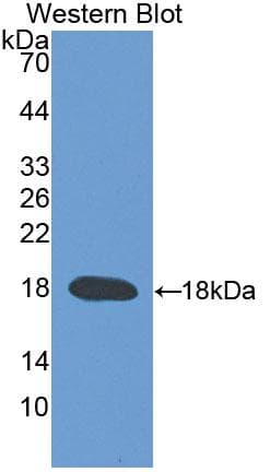 TRPV3 Antibody (aa671-790, PE)