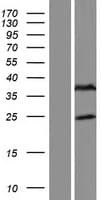 FAM166B Protein (Over-Expression Lysate Myc-DDK (Flag))